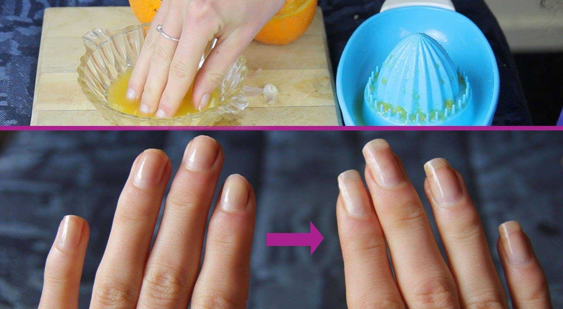 Как отрастить ногти за 1 день на 2 см в домашних условиях