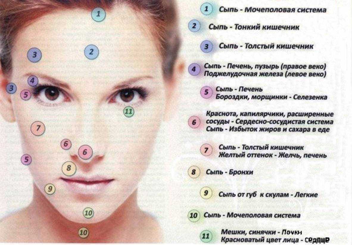 Аллергия на лице красные пятна - симптомы, причины, лечение