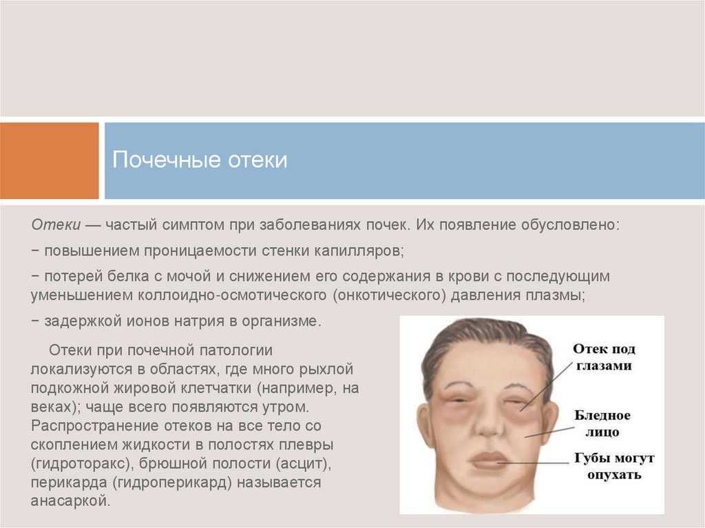 Помощь при ушибах и синяках на теле