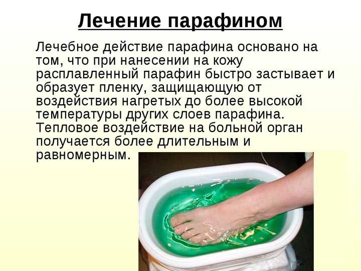 Парафинолечение: показания и противопоказания | food and health