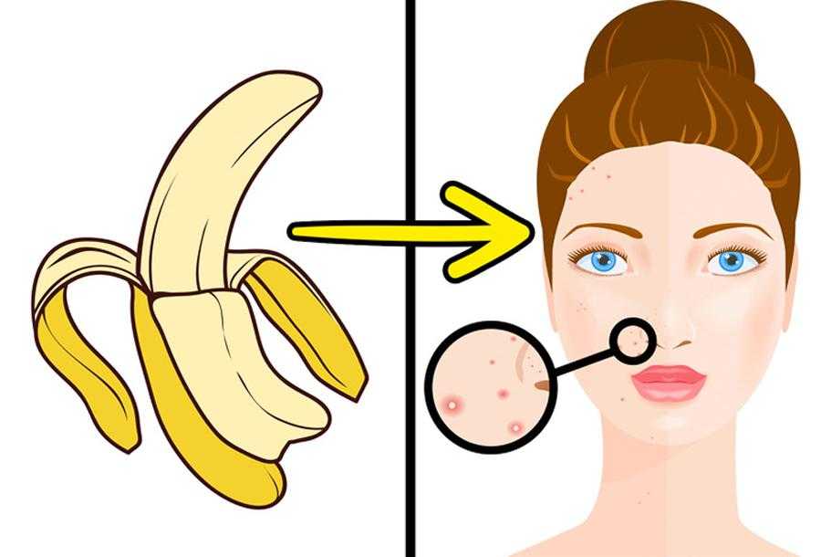 Польза банановой маски для лица и самые эффективные проверенные рецепты для домашнего применения