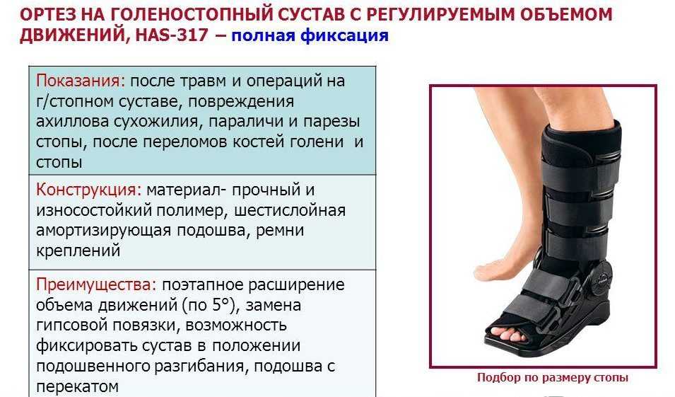 Зачем нужна лангетка на ногу при травме: разновидности, критерии выбора, противопоказания