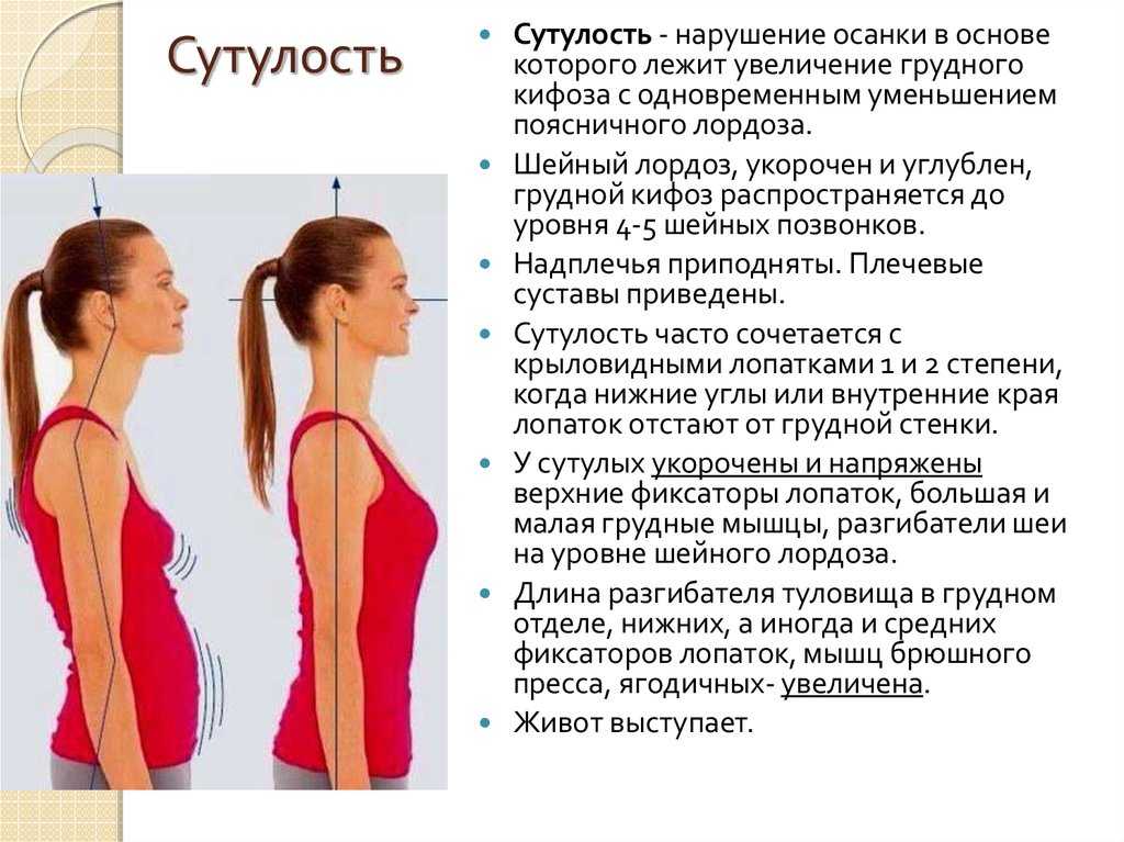 Противопоказания при сколиозе