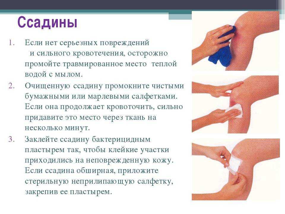 Лечение насморка: что и в каком случае поможет дышать - фарммедпром
