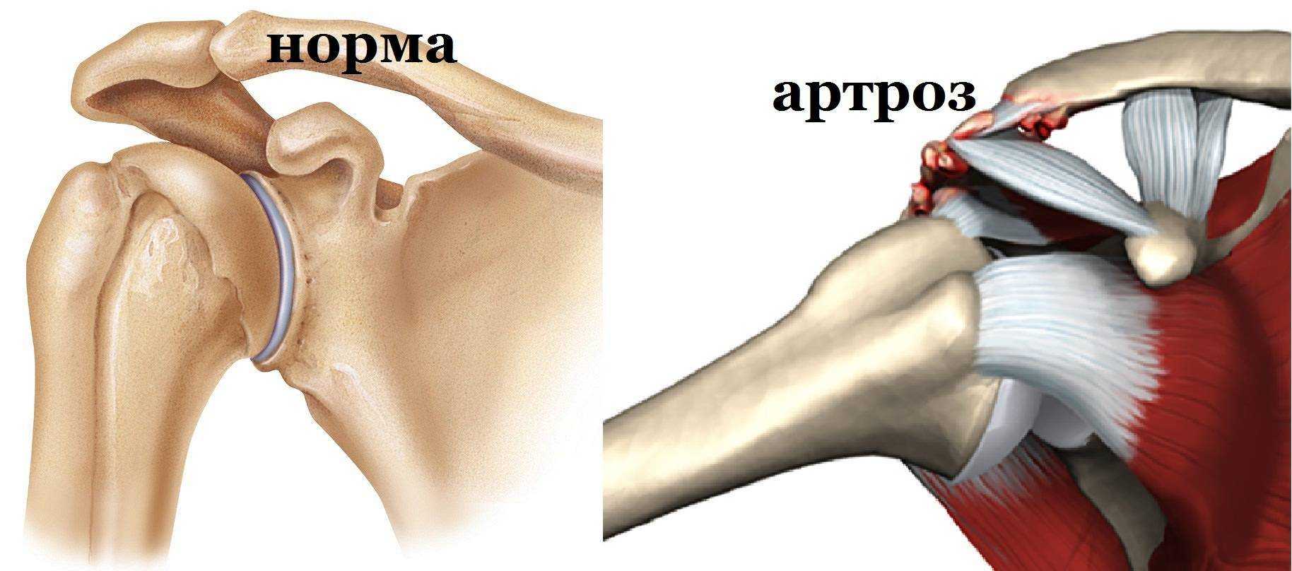 Как питаться чтобы суставы были здоровыми