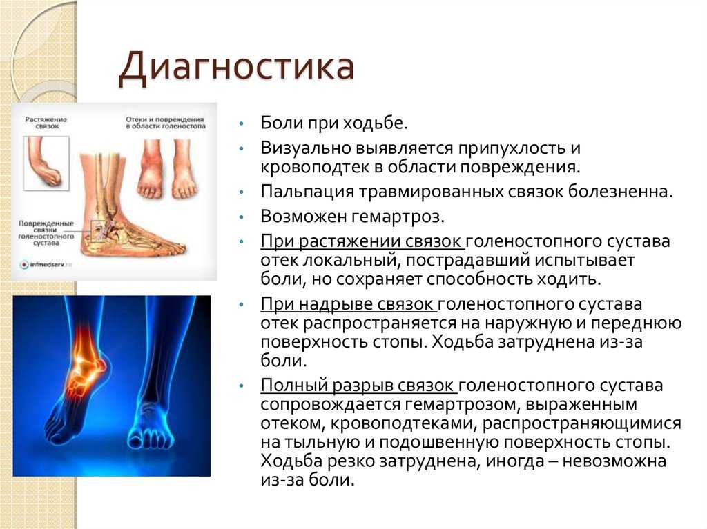 Флебит. как распознать болезнь и получить лечение | сосудистый центр.