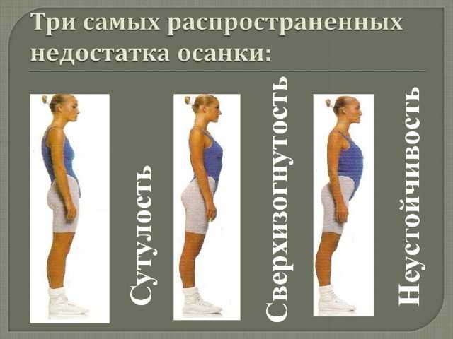 Королевская осанка это важная часть внешней красоты и здоровья | balproton.ru