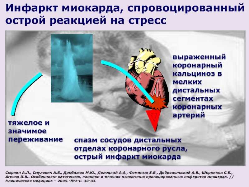 Кальциноз