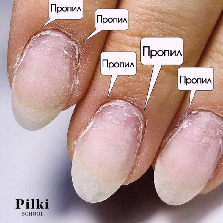 8 самых распространенных ошибок клиентов мастеров по маникюру - на каблуке