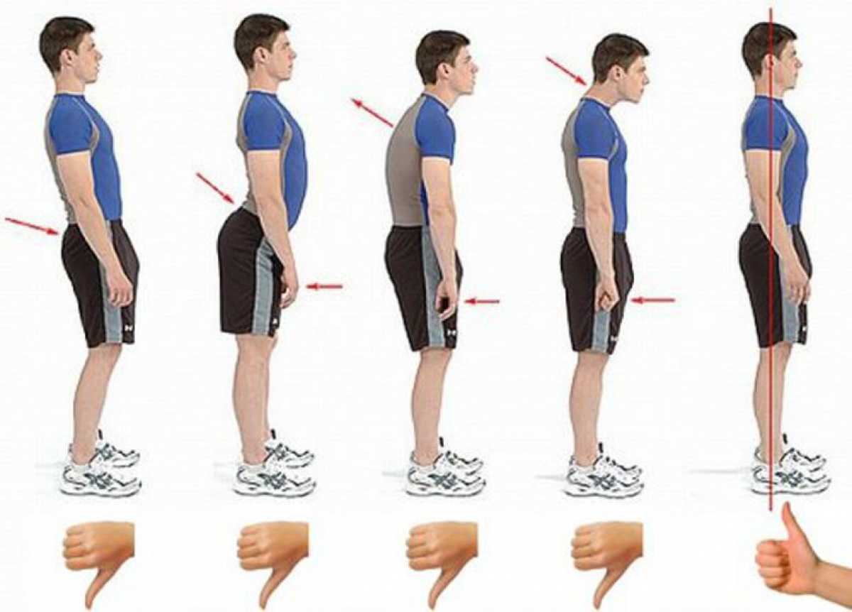 Почему при ходьбе головой. Лордоз поясничного отдела позвоночника упражнения. Гиперлордоз поясничного отдела у детей упражнения. Типы осанки лордоз кифоз. Лордоз поясничного отдела упражнения для исправления.