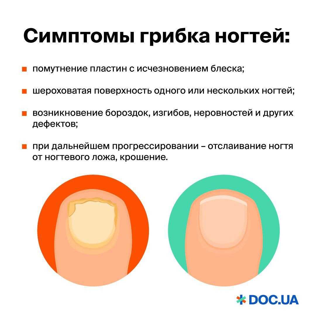 Самый безвкусный маникюр 2020 года, который может полностью испортить весь образ женщины