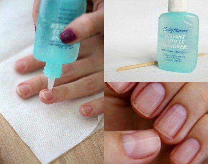 Как правильно убрать кутикулы на ногтях