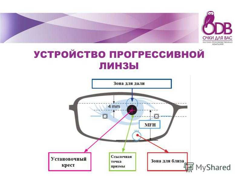 Подбор очков при анизометропии. часть i | ochki.com