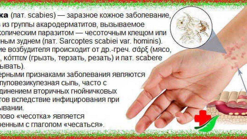 Зуд в промежности!