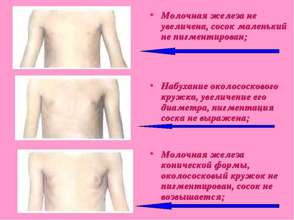 5 естественных способов уменьшить размер груди