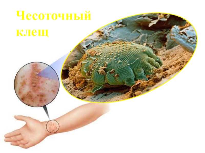 Лечение дерматита на лице
