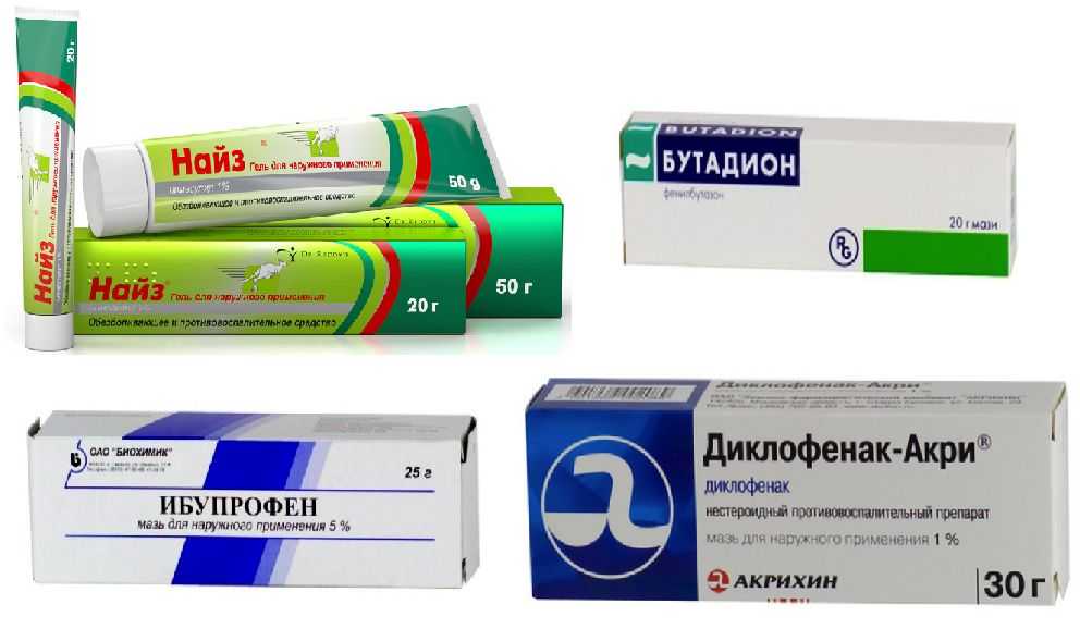 Причины подагры. симптомы и лечение приступа подагрического артрита
