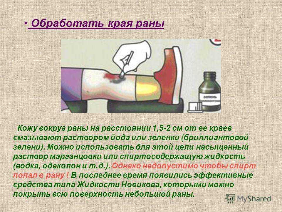 Как убрать синяк на носу быстро. как убрать сливу с носа быстро, как избавиться от сливы