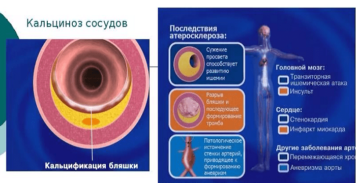Кальций (ca) в крови — норма, гипокальциемия, гиперкальциемия | университетская клиника