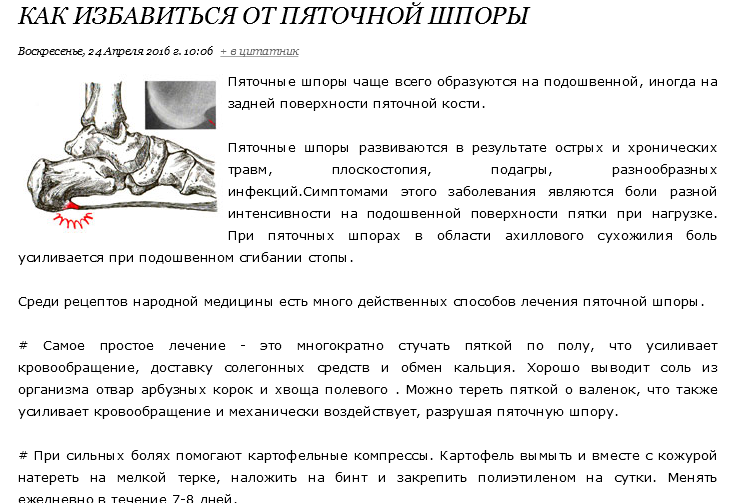 Подагра: симптомы и методы лечения. диета и препараты при подагре.
