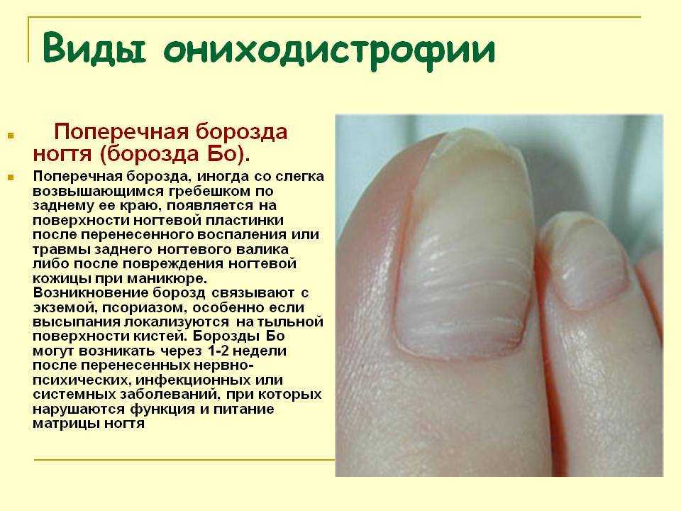 Все виды маникюра — сравнение, плюсы и минусы каждого. отзывы и советы женщин