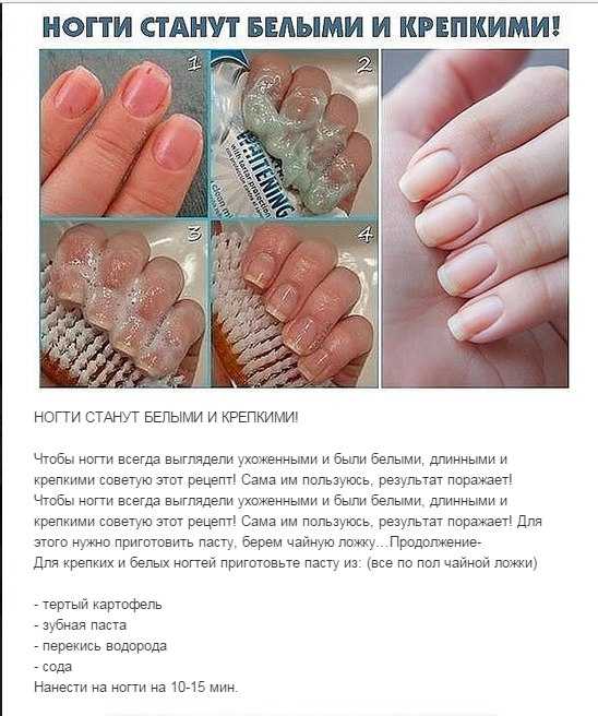 Средства для ускорения роста ногтей: как ускорить процесс?