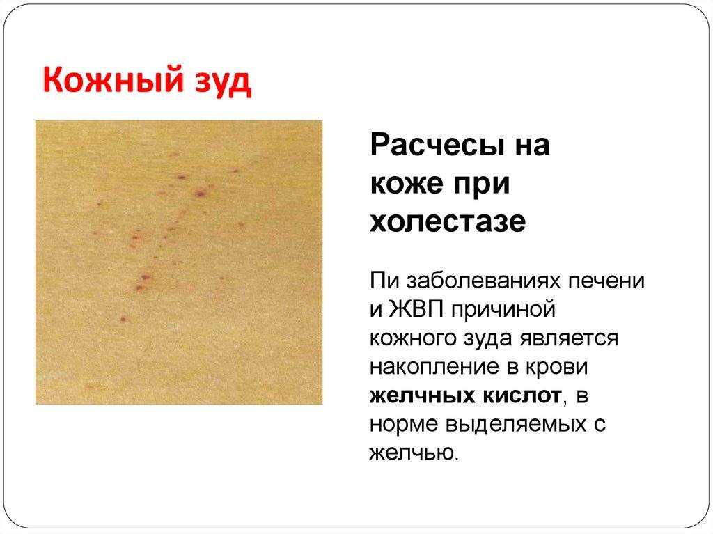 Скрытые особенности травмы левого колена. психосоматика