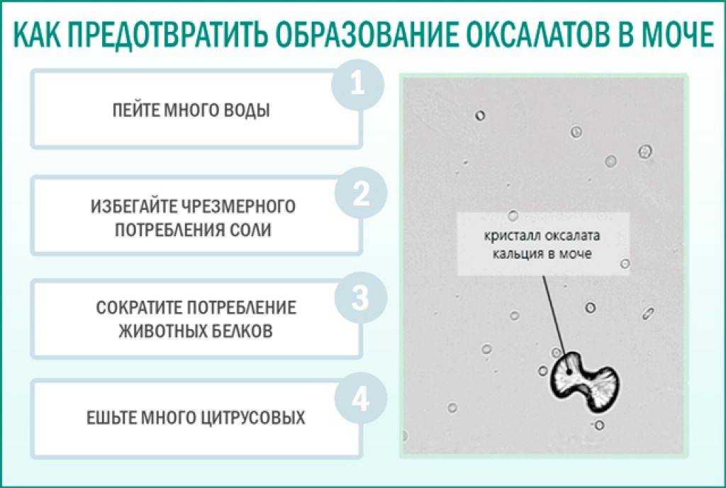 Оксалат кальция моногидрат вевеллит чем растворить. моя диета при оксалатных камнях