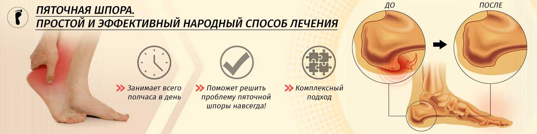 Как бороться с болью в суставе при артрозе: обзор обезболивающих средств